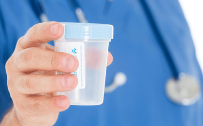 Urine Drug Testing Information